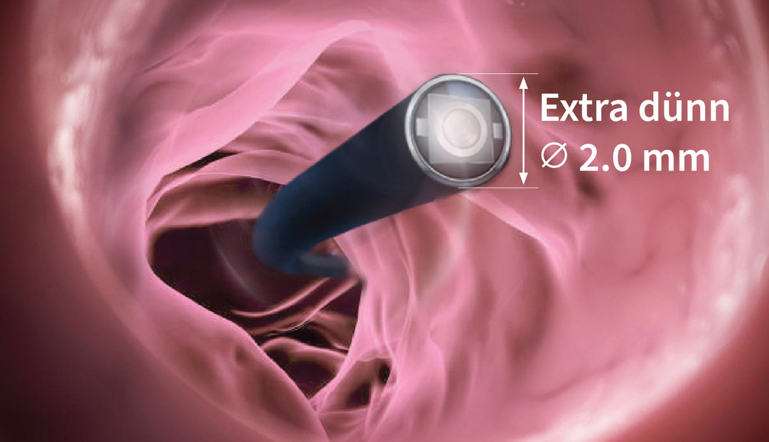 Flexible digitale Rhino-Laryngoskope EF-Serie
