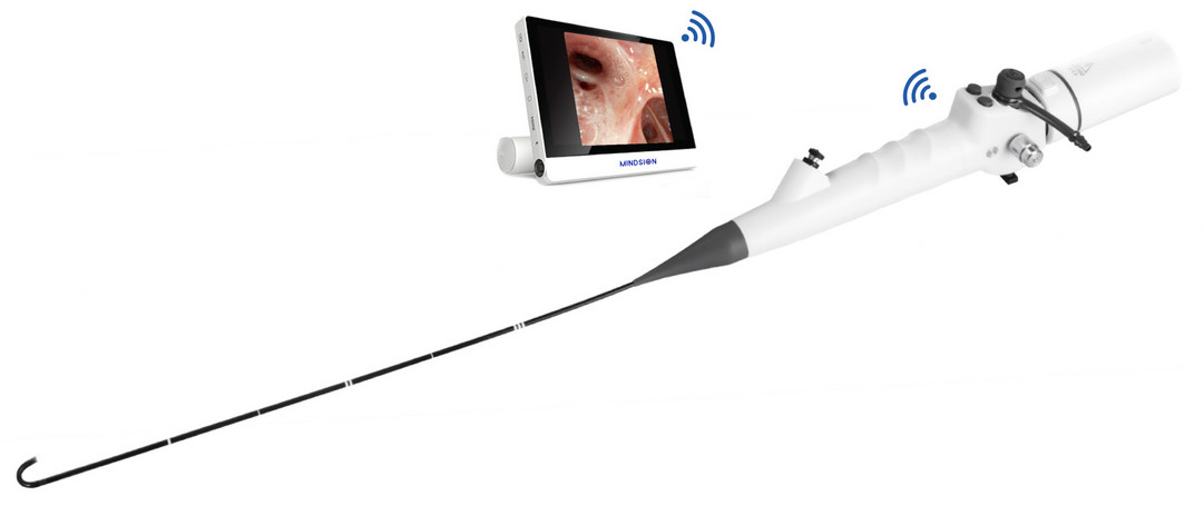 Flexible digitale Rhino-Laryngoskope EF-Serie