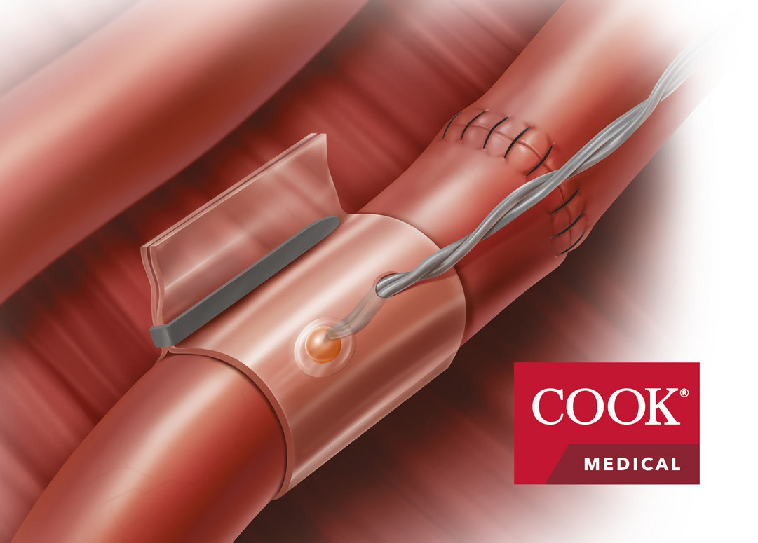 Doppler-Blutfluss-Monitor Doppler-Blutfluss-Monitor